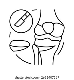 osteotomy surgery hospital line icon vector. osteotomy surgery hospital sign. isolated contour symbol black illustration