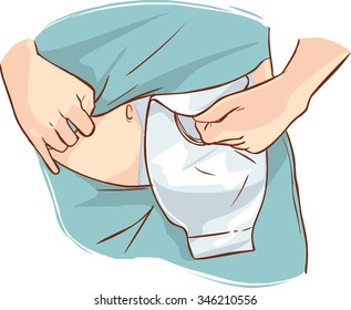 ostomy bag illustration