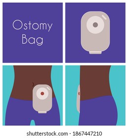 Ostomy bag vector illustration flat design