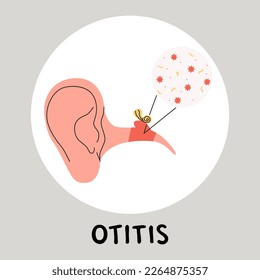 Otitis media flat vector medically illustration. Earache becouse of infection in the middle ear. Inflammatory diseases.