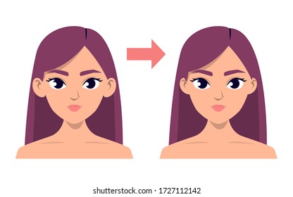 Otoplasty concept vector isolated. Before and after plastic surgery. Reshaping size of prominent ears. Idea of beauty.