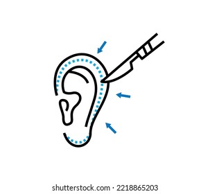 Otoplasty. Ear Surgery. Vector Illustration. Plastic Surgery
