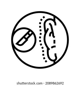 otoplasty surgery line icon vector. otoplasty surgery sign. isolated contour symbol black illustration