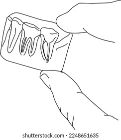 Outline sketch of hand holding small x-ray of teeth