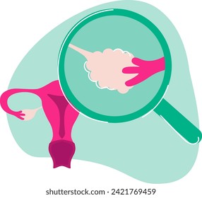 An ovary is a crucial organ in the female reproductive system, responsible for producing eggs, releasing hormones, and playing a key role in the menstrual cycle and fertility