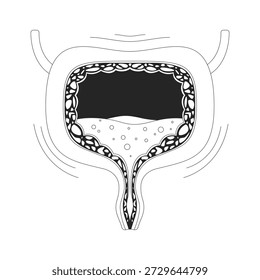 Vejiga humana hiperactiva con ilustración de contorno de síntoma de urgencia. Incontinencia urinaria, espasmos. Paredes temblorosas y acumulación de orina Objeto de línea 2D aislado en blanco. Imagen lineal de tinta de Vector monocromo