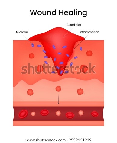 Overview of the Wound Healing