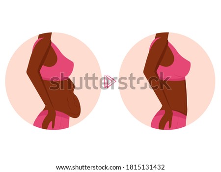 Overweight. Reducing fat in the abdominal area. Woman's body before and after weight loss, diet, fitness or liposuction.