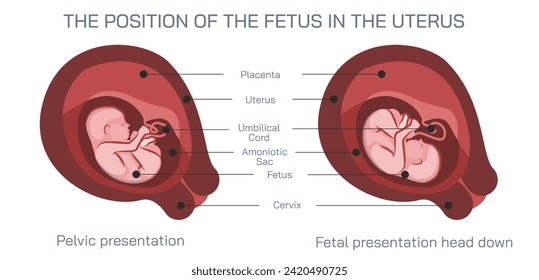 Vektorgrafik von Ovulation, Konzeption und Implantation. Anatomisches Diagramm der Befruchtung und des menschlichen Fortpflanzungsprozesses. Schüler lernen und erziehen Lernmaterialien.