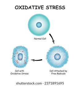 Oxidative stress diagram vector illustration design, Oxidative stress. From Normal cells to Oxidative stress and aggressive free radicals, cell death. Vector diagram for your design, educational