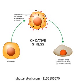 Oxidative Stress. From Normal Cell, To Oxidative Stress And Aggressive Free Radicals, Cell Death. Vector Diagram For Your Design, Educational, Science And Medical Use