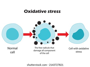 Oxidative Stress. From Normal Cells, To Oxidative Stress And Aggressive Free Radicals, To Cell Death.Educational And Study Content For Students Of Biology, Medicine And Science.vector Illustration.