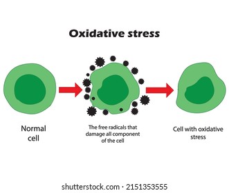 Oxidative Stress. From Normal Cells, To Oxidative Stress And Aggressive Free Radicals, To Cell Death.Educational And Study Content For Students Of Biology, Medicine And Science.vector Illustration.