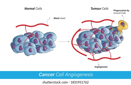 Oxygen And Nutrient Supply For Normal Somatic And Tumor Cell , Angiogenesis Of Blood Vessels Carrying Hemoglobin And Growth Factor: VEGF, Causing Cell Proliferation. Phagocytosis Of Cancer Cell Vector