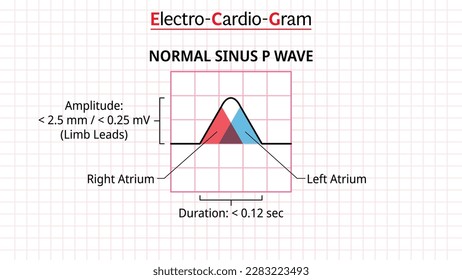 P Wave - ECG Sinus Normal - Electrocardiogram - Morphology P Wave - Vector Illustration