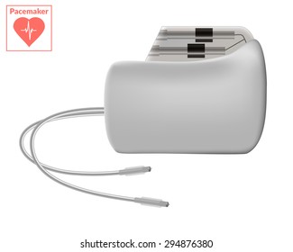 Pacemaker Isolated On White Background. Cardio Concept.