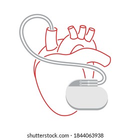 Pacemaker thin line illustration - human heart and cardio implant - vector isolated anatomic medical picture