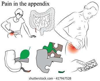 Pain In The Appendix. Pencil Drawing, Black And White Illustration. Pain In The Body, A Schematic Representation Of The Appendix And A Man With A Pain