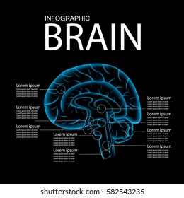 Pain in the Brain, x ray
