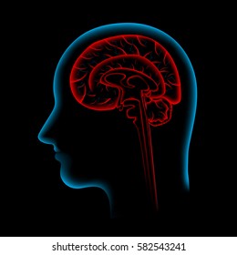 Pain in the Brain, x ray