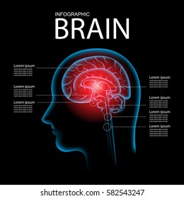 Pain in the Brain, x ray