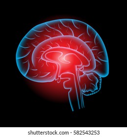 Pain in the Brain, x ray