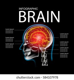 Pain in the Brain, x ray