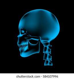 Pain in the Brain, x ray