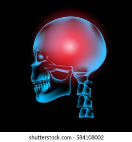 Pain in the Brain, x ray