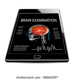 Pain in the Brain, x ray, examination