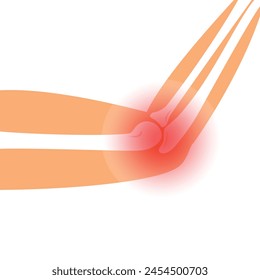 Pain in the elbow. Illustration of the elbow in section. bones of the hands. The concept of elbow injury.