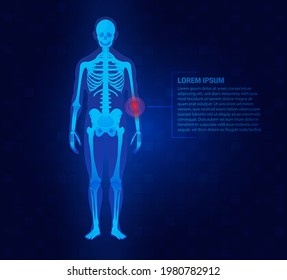 Pain of the elbow joints concept as skeleton. Blue background and red injury man body leg medicine template. Painful Joints.Rheumatism or rheumatic disorder medical.