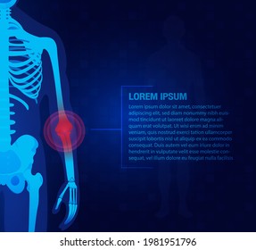 Pain of the elbow joints concept as skeleton. Blue background and red injury man body leg medicine template. Painful Joints.Rheumatism or rheumatic disorder medical.