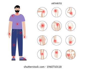 Dolor en el cuerpo humano. Silueta de hombre. Columna, cadera de rodilla y otros íconos articulares. Artritis, inflamación, estructura ósea y concepto de cartílago. Afiche médico para la clínica. Ilustración vectorial plana de rayos X