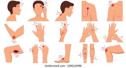 Pain in the human body parts physical injury flat set caused by illness or injury isolated on white background, vector illustration.