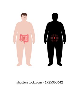 Pain, Inflammation In Intestine. Adult Obese Man Anatomy Poster. Ache In Overweight Male Human Body. Internal Organ Exam Concept. Cancer, Disease, Digestive System Problem Flat Vector Illustration.