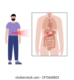 Pain or inflammation in pancreas. Adult man anatomy poster. Diabetes, ache in male human body. Internal organs exam concept. Pancreatic cancer. Problem in digestive system flat vector illustration