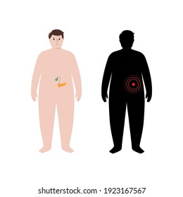 Dolor, inflamación en el páncreas. Afiche de anatomía masculina para adultos obesos. Diabetes, dolor en el cuerpo humano masculino con sobrepeso. Examen de órganos internos. Cáncer de páncreas. Ilustración del vector de problema del sistema digestivo.