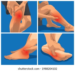 Schmerzen und Verletzungen in Körperteilen. Frau fühlt Schmerzen in Knie, Kalb, Knöchel und Sohle. 