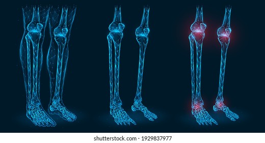 Pain, injury or inflammation in the knees and ankles polygonal vector illustration. Low poly model of diseased knee and ankle joints.