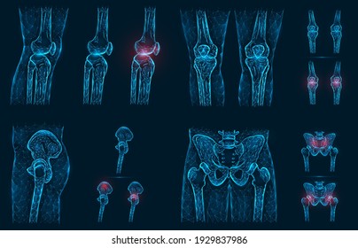 Pain, Injury Or Inflammation In The Knees And Pelvis Polygonal Vector Illustration. Low Poly Model Of A Sore Knee, Hip And Hip Joint.