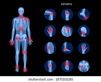 Pain in male human body. Man skeleton silhouette. Spine, knee, other joint icons. Arthritis, inflammation, fracture, bone structure and cartilage concept. Medical poster. Flat xray vector illustration