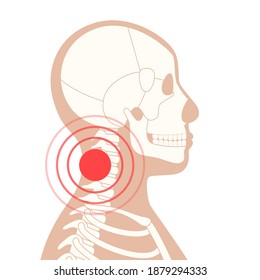 Pain in neck or spine bones. Skeleton x ray silhouette medical poster. Joints and cartilage in human body concept. Rheumatoid arthritis, inflammation, backbone disease concept flat vector illustration