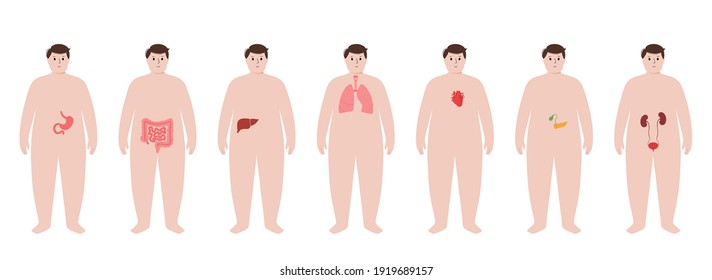 Pain in obese man body. Problem with liver, pancreas, lungs and other organs in overweight male silhouette. Disease of digestive, respiratory, cardiovascular and urinary systems vector illustration.