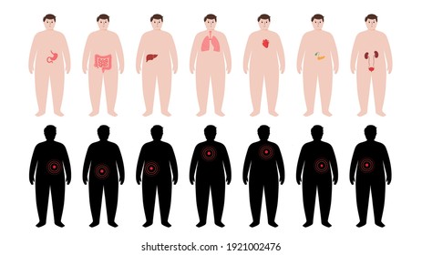 Dolor en el cuerpo de un hombre obeso. Problema con el hígado, páncreas, pulmones y otros órganos en la silueta masculina con sobrepeso. Enfermedad digestiva, respiratoria, cardiovascular y urinaria ilustración vectorial.