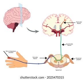 Pain Pathway. Nociception.  Ascending pathway that connect the periphery with the brain during pain and temperature sensation. Hand, spinal cord and brain. 