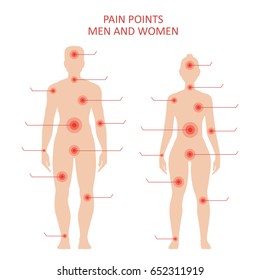 Pain points on male and female body, sensitive spots for medical treatment, educational poster. Vector flat style illustration isolated on white background