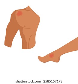 Pain in shoulder, leg. Vector illustration