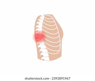 Pain in spin joint Arthritis back joint pain syndrome spin Skeleton Bones Pain Injury and Inflammation vector illustration.