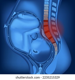 Pain in the spine and back during pregnancy. baby in the uterus. Neon rendering of female anatomy. Blue background for advertising. Vector illustration